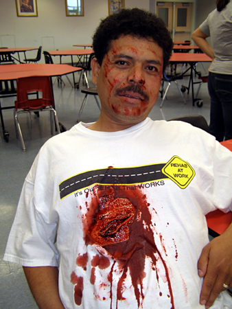 Open Chest Wound